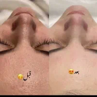فیشیال .اسپای روسی.میکاپ حرفه ای فقط سه روز|خدمات آرایشگری و زیبایی|ایلام, |دیوار