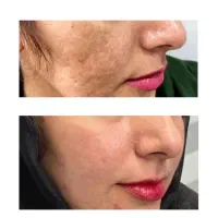 روغن تراپی|آرایشی، بهداشتی، درمانی|نهبندان, |دیوار