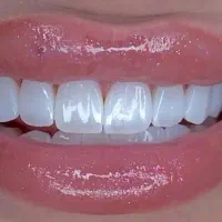 دندان پزشکی اقتصادی با کادر مجرب