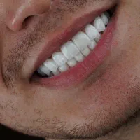 دندان ، دندانپزشکی ، لمینت ، کامپوزیت ، ایمپلنت|خدمات آرایشگری و زیبایی|مشهد, دانشجو|دیوار