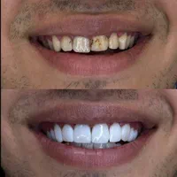 آموزش حرفه ای کار درمانی و زیبایی دندانپزشکی|خدمات آموزشی|تهران, مهرآباد جنوبی|دیوار