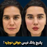 فیلر بادی باسن سینه بیکینی دست غبغب شکم دکتر زنان|خدمات آرایشگری و زیبایی|مشهد, هفت تیر (آب و برق)|دیوار