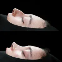 جشنواره تخفیفات جراحی بینی/عمل بینی|خدمات آرایشگری و زیبایی|کاشان, الغدیر|دیوار