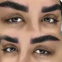 فیبروز میکروبلیدینگ