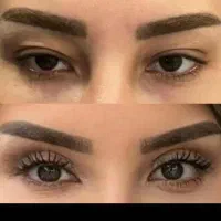/بلفاروپلاستی/لیفت ابرو/لیفت شقیقه/ساکشن غبغب