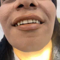 خدمات دندانسازی مروارید|خدمات آرایشگری و زیبایی|دهدشت, |دیوار