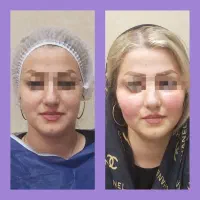 اف عمل های زیبایی در اهواز