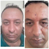 پوست ،زیبایی|خدمات آرایشگری و زیبایی|رباط‌کریم, الارد|دیوار