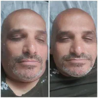 لاغری شکم پهلو ران بازو مزو مو مزو غبغب لیفت سینه|خدمات آرایشگری و زیبایی|تهران, سبلان (لشگر)|دیوار