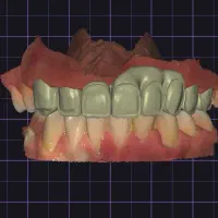 تکنسین لابراتوار دندانسازی