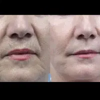 پک چین وچروک