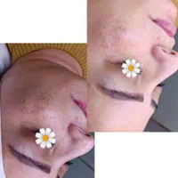 فشیال وپاکسازی صورت|خدمات آرایشگری و زیبایی|نیشابور, شهرک اندیشه|دیوار