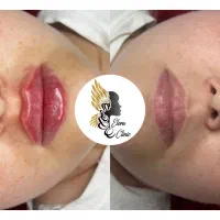 زیبایی ماندگار با خدمات تخصصی ژل و بوتاکس|خدمات آرایشگری و زیبایی|صدرا-فارس, فاز ۱|دیوار