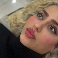 تزریق فیلر فول فس،تزریق فیلر بادی ،تزریق چربی