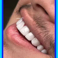 دندانپزشکی ایمپلنت|خدمات آرایشگری و زیبایی|تهران, آرژانتین|دیوار