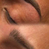 خدمات میکروبلید و فیبروز،شیدینگ لب