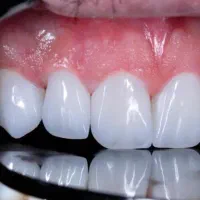 دندانپزشکی اقساطی با تعرفه مناسب|خدمات آرایشگری و زیبایی|هشتگرد, شهرک ولیعصر (مصلی)|دیوار