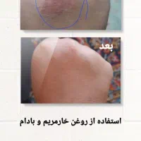 روغن های گیاهی کاژان|آرایشی، بهداشتی، درمانی|تربت‌حیدریه, شهرک ولیعصر|دیوار