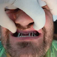 لابراتوار دندانسازی ایمپلنت تخصصی|خدمات آرایشگری و زیبایی|تهران, توحید|دیوار