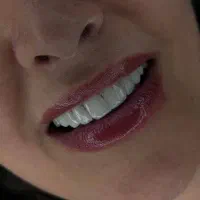 کامپوزیت دندان سارمکو - شرایط استثنائی و مدت محدود|خدمات زیبایی و سلامت|تهران, دروس|دیوار