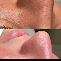 فیشیال تخصص و پدیکور و جوان سازی دست|خدمات آرایشگری و زیبایی|سرپل ذهاب, |دیوار