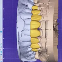 استخدام کارآموز و قالبریز