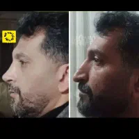 جشنواره تخفیف عمل زیبایی بینی|خدمات آرایشگری و زیبایی|قائم‌شهر, |دیوار