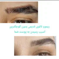 تخفیف پائیزه ریموو ،شیدینگ لب به مدت محدود|خدمات آرایشگری و زیبایی|محمدیه-قزوین, |دیوار