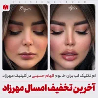 ژل لب با متد M تکنیک مهرزاد|خدمات آرایشگری و زیبایی|تهران, اباذر|دیوار