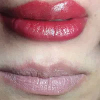 فیبروز ،میکرو بلیدینگ ،شیدینگ