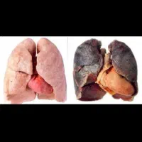 پاکسازی ریه