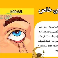 خانمای عزیز بگوش باشید|آرایشی، بهداشتی، درمانی|اصفهان, ارغوانیه|دیوار