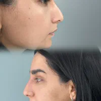 کلینیک بوتاکس وفیلر و هایفو و فیلر بادی و ریموتتو|خدمات زیبایی و سلامت|کرج, عظیمیه|دیوار