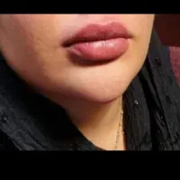 جشنواره تخفیف بوتاکس|خدمات آرایشگری و زیبایی|قم, صفاشهر|دیوار