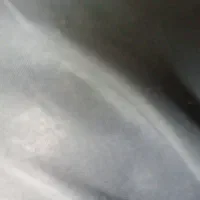 یک بسته طاق پرده گم شده