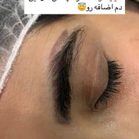 ریموو تک جلسه  با تخفیف ویژه|خدمات آرایشگری و زیبایی|تربت جام, پاسداران|دیوار