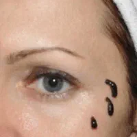 زالو فروش زالو ۱۵۰هزار تومان