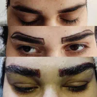 کاشت تخصصی مو در شیراز|خدمات آرایشگری و زیبایی|بوشهر, |دیوار