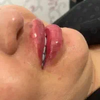 تزریق ژل فقط سیسی ۸۰۰بمدت سه روز|خدمات آرایشگری و زیبایی|زاهدان, |دیوار