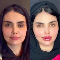 کلینیک پوست زعفرانیه نسل جدید بوتاکس گازی نخ فیلر|خدمات آرایشگری و زیبایی|تهران, زعفرانیه|دیوار