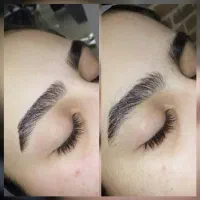 اصلاح تخصصی صورت و ابرو باهم  فقط ۲۰۰ تومان