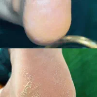 پدیکور و مانیکور