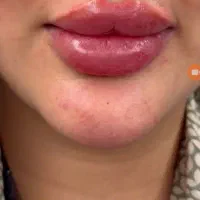 مدل ژل لب روسی۳۵۰ونخ لیفت۷۰۰وو فول فیس وژل بادی۵۰۰|خدمات آرایشگری و زیبایی|تهران, آهنگ|دیوار