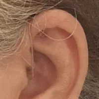 ارزیابی شنوایی و تجویز سمعک|پزشکی|شیراز, معالیآباد|دیوار