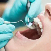 تخفیف ویژه دندانپزشکی به مناسبت قربان تا غدیر