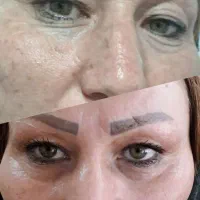 حذف دائمی کم و مک (تضمینی در یک جلسه)|خدمات آرایشگری و زیبایی|تایباد, |دیوار