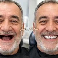 دندان مصنوعی، دست دندان،تعمیرات،دندانسازی|خدمات زیبایی و سلامت|تهران, هاشمآباد|دیوار