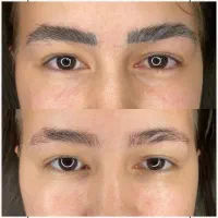 مدل پاک کردن تتو