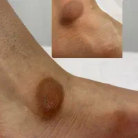 تیرگی هاتو نابود کن(خدمات فقط خانم ها)