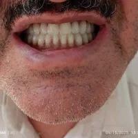 لابراتوار ساخت دندان( تاقمه )